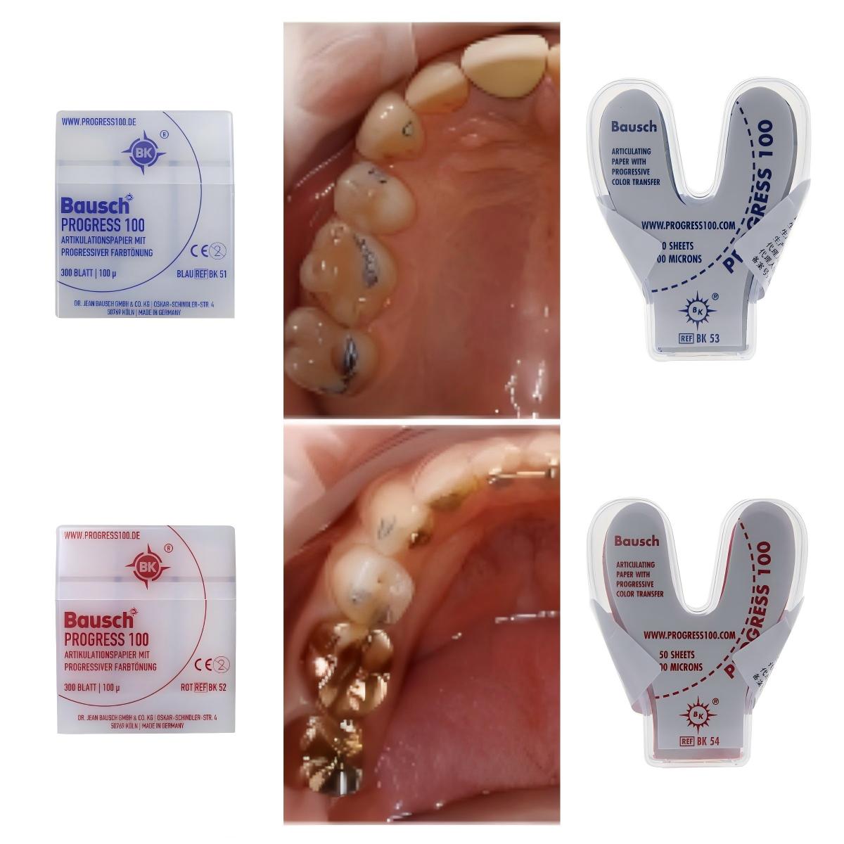 Papier d'articulation dentaire - Bite Indicator avis et prix